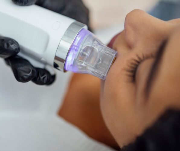 Close-up of specialised microneedling device delivering advanced skincare rejuvenation therapy on client in beauty academy.